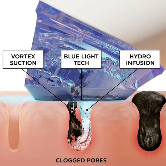 NWT BeautyBio GLOfacial Hydro-Infusion Pore Cleansing + Blue LED Clarifying Tool - Picture 5 of 10